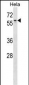 AGFG1 Antibody (N-term)